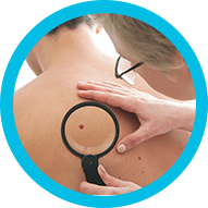 Skin Cancer Image