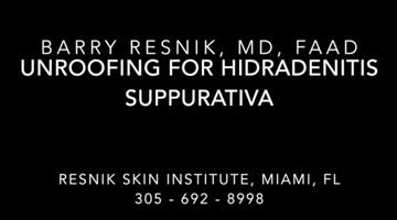 Unroofing for Hidradenitis Suppurativa HS