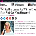 Tori Spelling Leaves Spa With an Especially Red, Splotchy Face: Find Out What Happened!